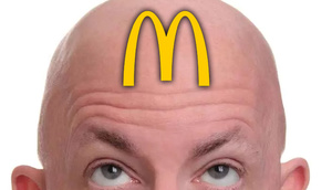 Yapon elm adamları McDonald's kartofu ilə keçəlliyə çarə tapdılar!