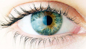 Eynəkləri atma vaxtı: Korneanı düzəldəcək yeni üsul gəlir