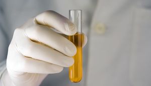 Bədəndə olan bu maye, sağlamlığınız haqqında ipucları verir!