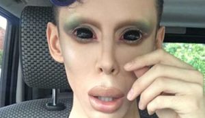 Yadplanetlilərə bənzəyən gəncin son istəyi həkimləri ŞOKA SALDI - Baxın nədən imtina etmək istəyir?