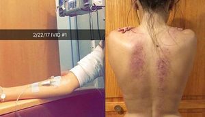 Xəstəliyə yoluxdu, kəskin ağrılardan bədəni bu hala qaldı - FOTOLAR