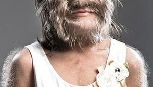 Sevgi bu qızın üzünü tamam dəyişdi - FOTO