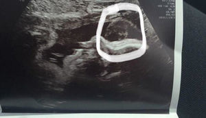 Körpəsinin ultrasəs müayinəsində ölən nənəsini görən qadın dəhşətə gəldi - FOTOLAR