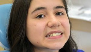 Çıxan dişini südün içərisinə qoydu, sonrasına özü belə inana bilmədi - FOTOLAR