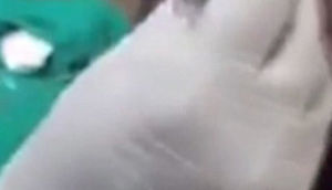 Şok kadrlar: Oğlanın başından görün nə çıxarıldı - VİDEO