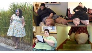 292 kilo olmuşdu, indiki halını görənlər təəccüb içərisində - FOTOLAR