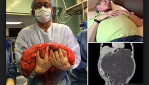 Həkimləri məcbur etdi ki, onun qarnını yarsınlar- VİDEO