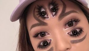 Üzünün müxtəlif yerlərində göz "əmələ gəlir" — Görənləri şoka salan qızın FOTOLARI