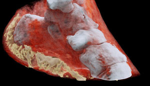 İlk üçölçülü rəngli rentgen şəkli çəkilib