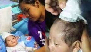 Buynuzlu uşaq dünyaya gəldi - Tibb dünyası şokdadır - VİDEO