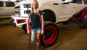 Mini ətək geyinmək üçün ayağını kəsdirdi - FOTO