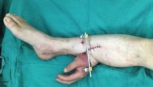 ŞOK! Xəstənin əlini kəsib ayağına tikdilər - FOTOLAR