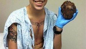 Əməliyyatdan çıxan oğlanın əlindəkinin nə olduğunu bilsəniz, təəccüblənəcəksiniz - FOTO