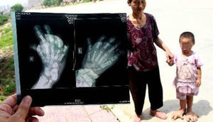 3 yaşlı uşağın ayaqları görənləri şoka saldı - FOTO