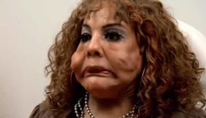 Üzünə sement vurulan qadın dəhşətə gətirdi - FOTO