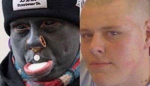 Döymə etdirən gənc tanınmaz hala düşdü - Fotolar