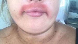 Qadın "bığ"ını aldırmaq istədi, bu hala düşdü - FOTO