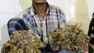 Gənc oğlanın əl və ayaqlarından ağaclar çıxır - FOTOLAR