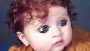 Hər kəsdən fərqli doğuldu, ancaq... - FOTOLAR