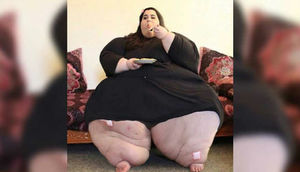 Bu qız 121 kilo arıqladı — FOTOLAR