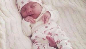 Ağ saçlı körpə doğuldu: Həkimlər şoka düşdü - FOTO