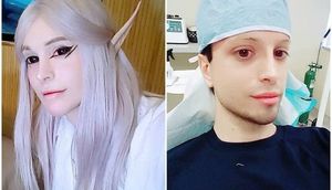 "Canlı elf" olmaq istəyən oğlan - FOTOLAR