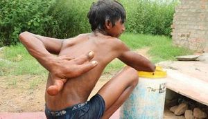 Hamı onu şeytan adlandırır - 12 yaşlı uşağın lənətli olduğuna inanırlar + Foto