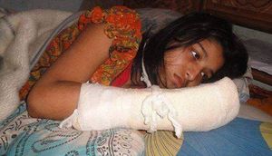 Əri "Sənə sürprizim var" deyib, gözlərini bağladı, barmaqlarını kəsdi - SƏBƏBİ ŞOK ETDİ