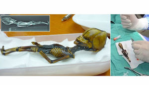 Tapılan bu yadplanetli anormal qız uşağı imiş