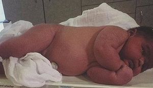 Dünya şokda! Anasının qarnından belə çıxdı - FOTO