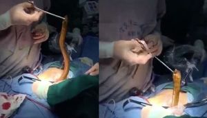 DÜNYA ŞOKDA! Mədəsindən İLAN ÇIXDI