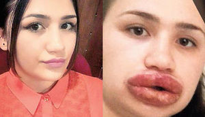 Qızın dodaqlarını yaman günə qoyan "həkim" CİNAYƏTKAR İMİŞ...