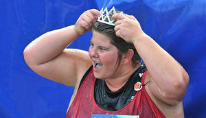 Həkimin bir sualı 140 kq-lıq qadını tanınmaz hala saldı - FOTO