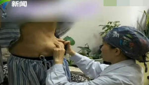 O qədər silikon vurdurdu ki, sinəsi qarnına düşdü (+18 FOTOLAR)