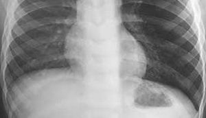 Öskürərkən fit səsi eşitdilər, həqiqət xəstəxanada ortaya çıxdı – Video