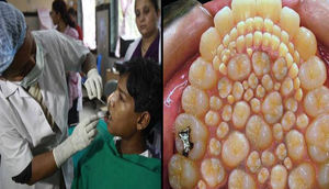 ŞOK: 17 yaşlı gəncin ağzından görün nə qədər diş çəkdilər - FOTOLAR