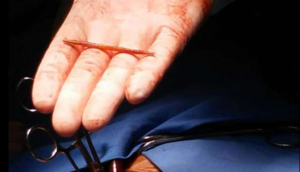 Diş çöpünə qurban getdi - ŞOK ÖLÜM