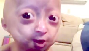 Bu uşağı görənlər şoka düşür - VİDEO