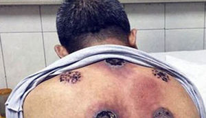 Kürəyinə banka qoydurdu, bu günə düşdü - FOTOLAR