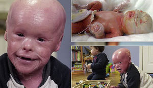 Yaşaması üçün dərisini soyurlar - FOTOLAR