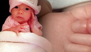 Qızdırması qalxan körpənin ayağını açıb gördülər ki... - FOTOLAR