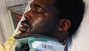 Siqaret ağzında partladı, görün nə oldu - FOTO