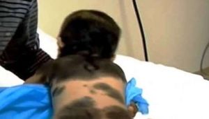 1 yaşlı uşağın bu problemi həkimləri şoka saldı - VİDEO